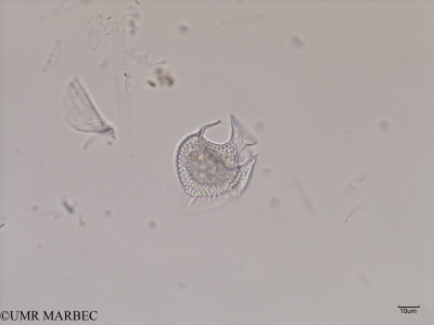 phyto/Scattered_Islands/iles_glorieuses/SIREME May 2016/Histioneis crateriformis (SIREME-Glorieuses2016-GLO5surf-51016-dinophysis-4)(copy)_thumb.jpg